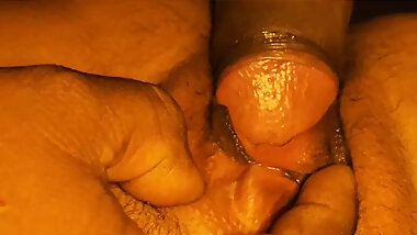 Sister-in-law's rash itching mitigated